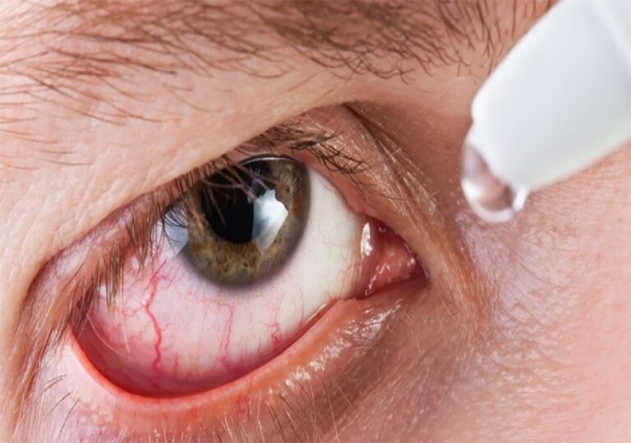 Perigos do Frio para os Olhos: Prevenção é Essencial